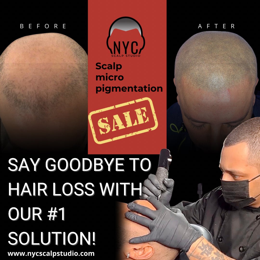 What happens to scalp micropigmentation when you get older? - Scalp Micro  USA