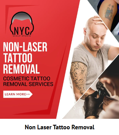 Everything You Need to Know about Laser Tattoo Removal 101❤️